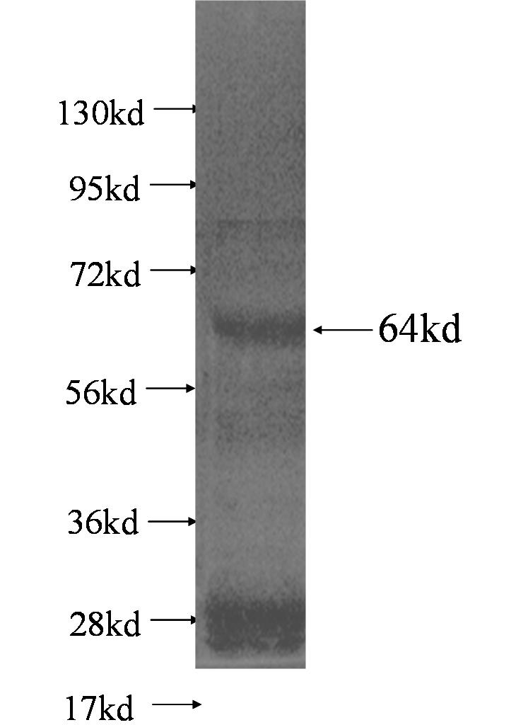 RENALASE fusion protein Ag1394 SDS-PAGE RENALASE fusion protein Ag1394 SDS-PAGE