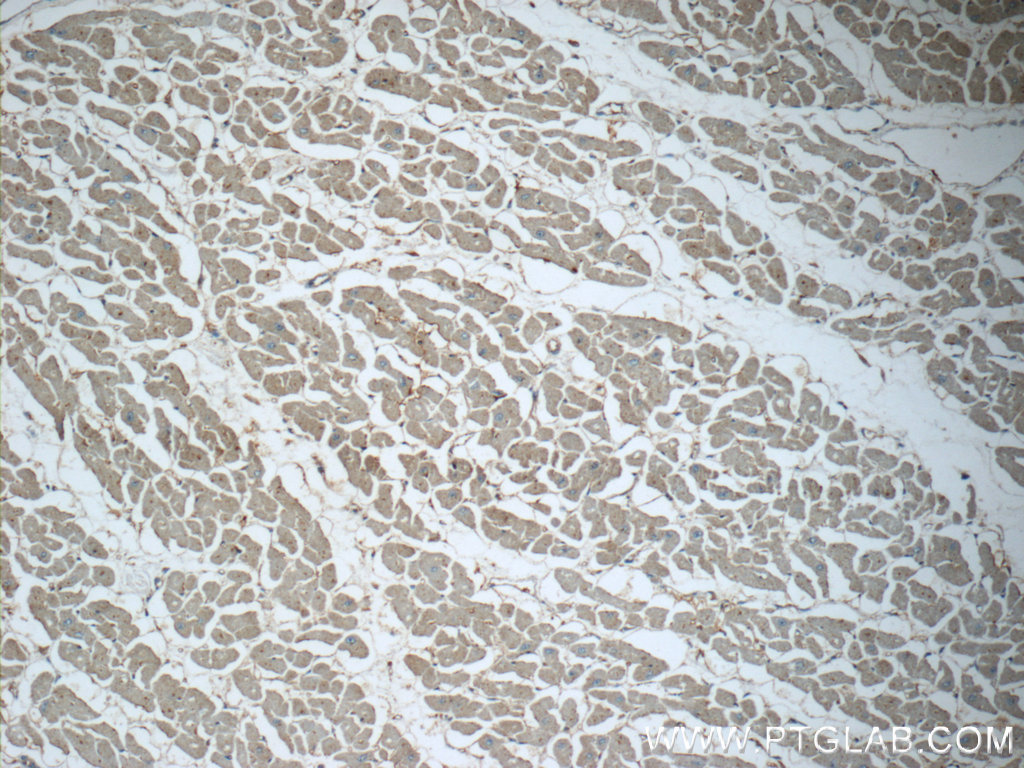 IHC staining of human heart using 10926-1-AP