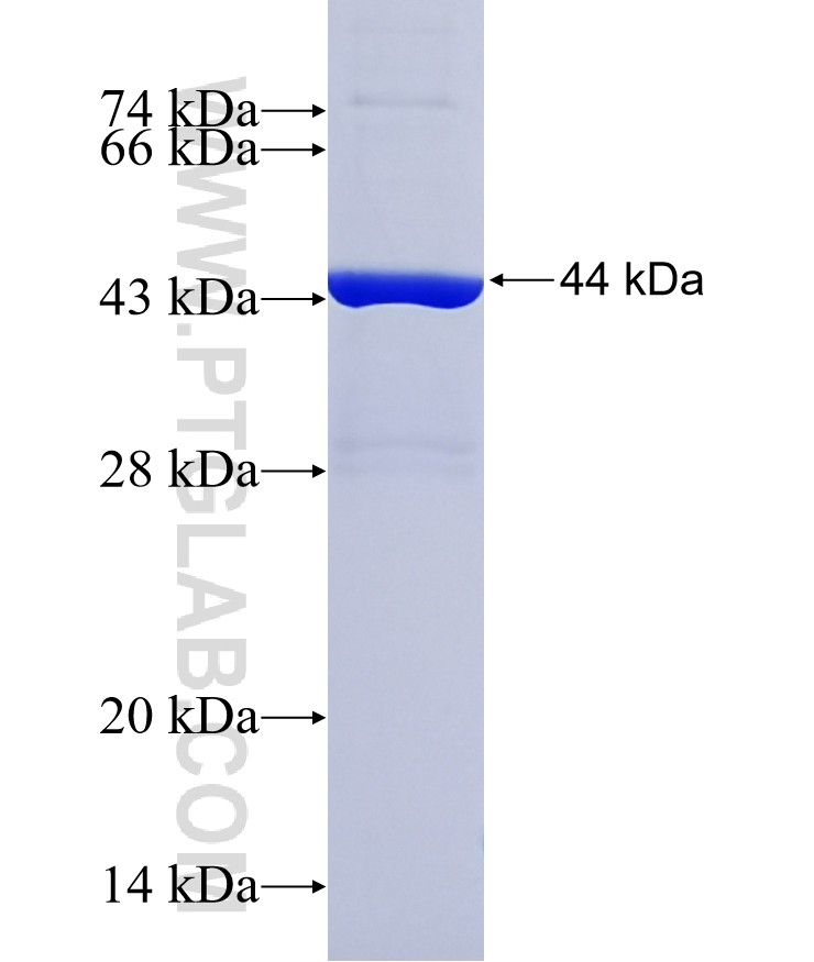 REP15 fusion protein Ag36998 SDS-PAGE REP15 fusion protein Ag36998 SDS-PAGE