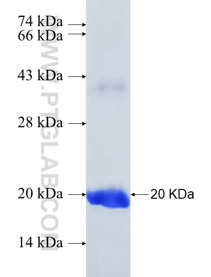REP15 fusion protein Ag37022 SDS-PAGE REP15 fusion protein Ag37022 SDS-PAGE