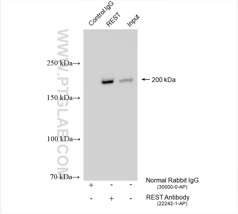 IP experiment of HeLa using 22242-1-AP