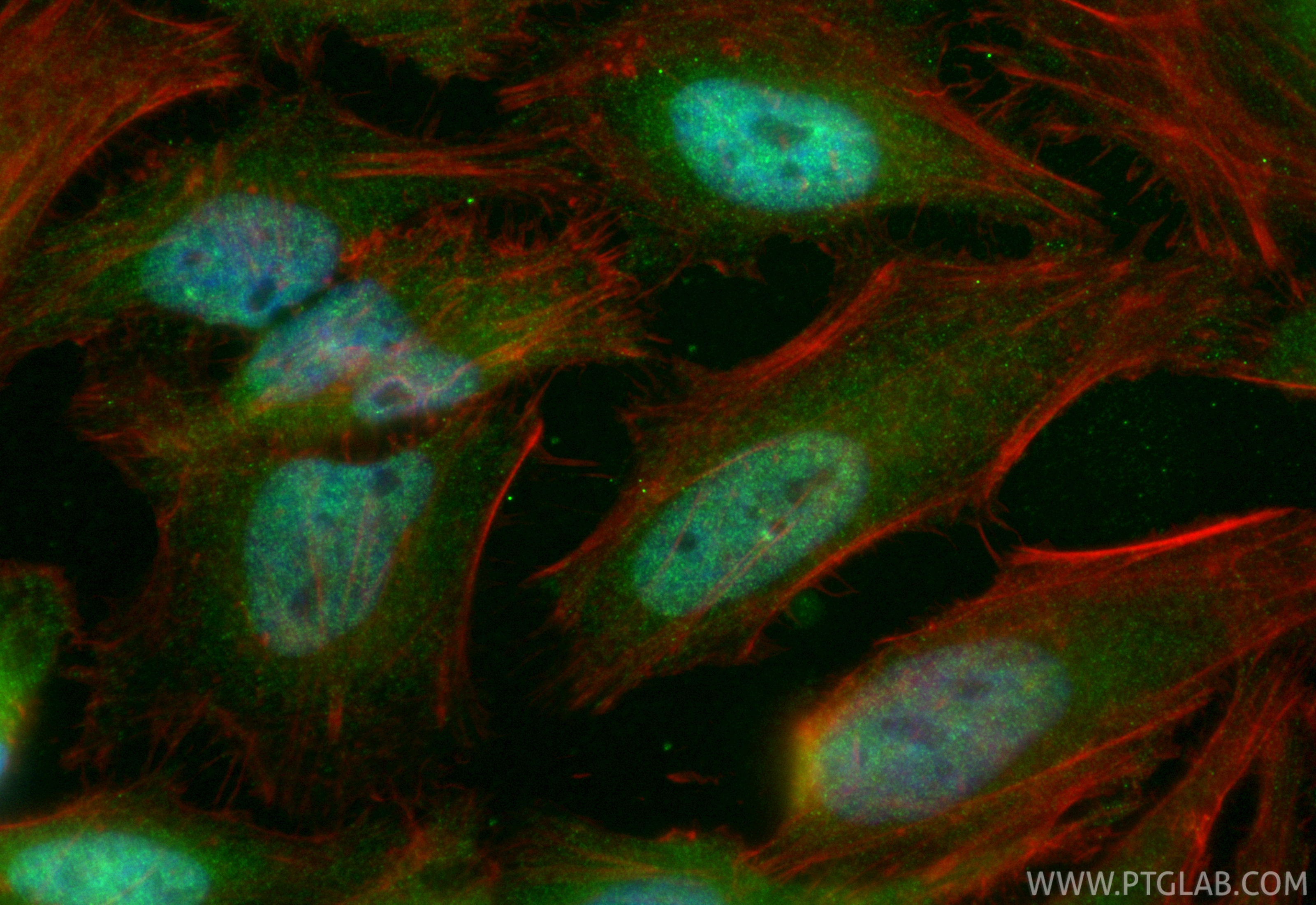 Immunofluorescent analysis of (4% PFA) fixed HeLa cells using CoraLite® Plus 488 REST antibody (CL488-84846-4, Clone: 241789D3 ) at dilution of 1:200, CL594-Phalloidin (red). IF Staining of HeLa using CL488-84846-4