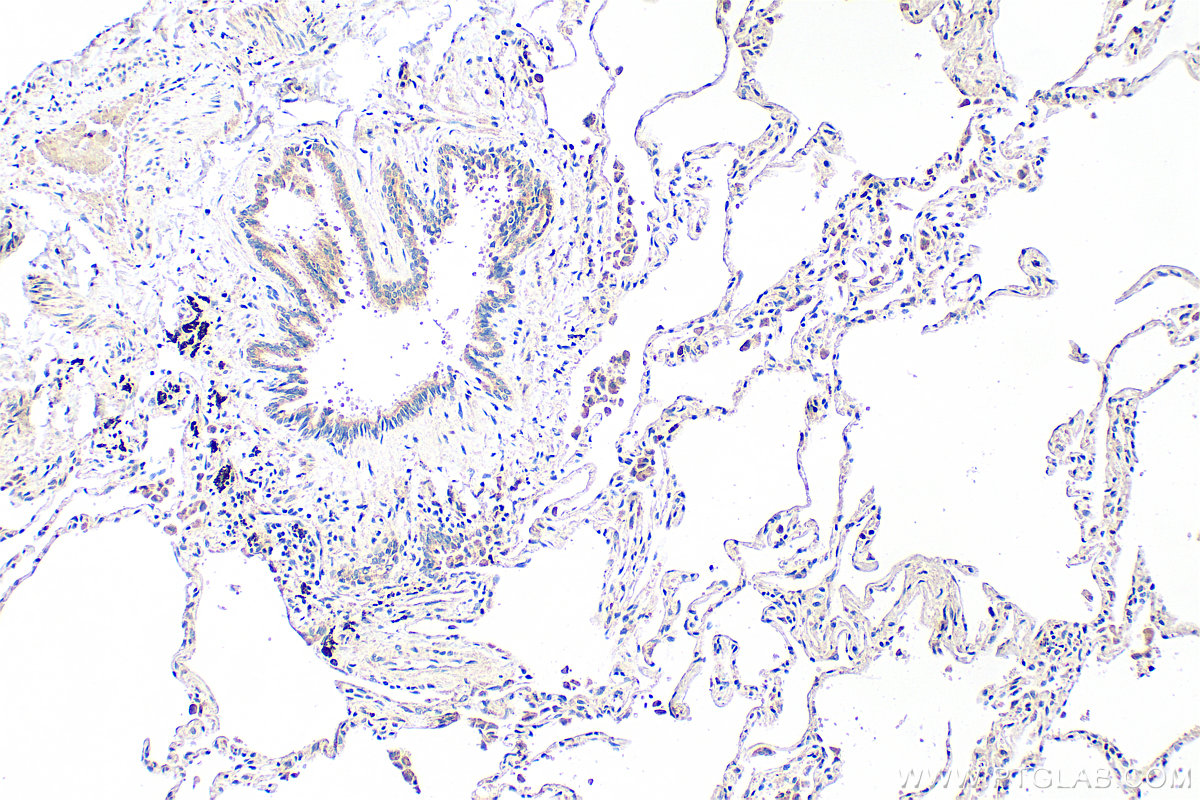 IHC staining of human lung using 18170-1-AP