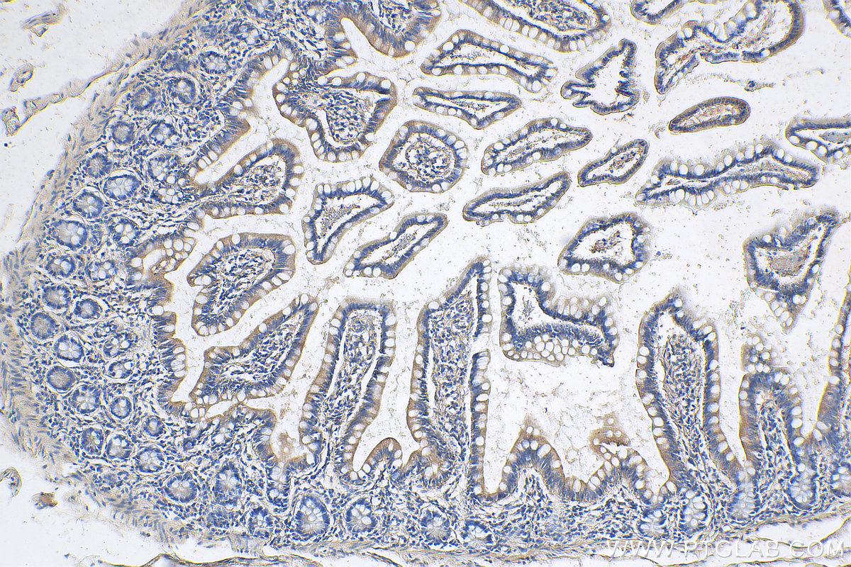 IHC staining of human small intestine using 18232-1-AP