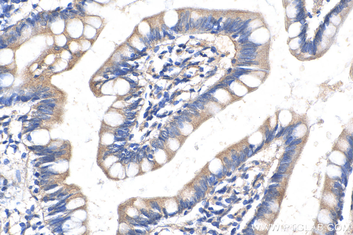 IHC staining of human small intestine using 18232-1-AP