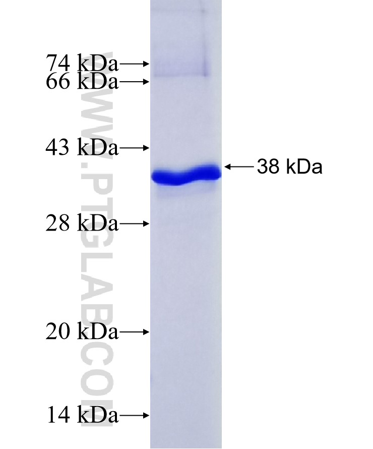 RETSAT fusion protein Ag10866 SDS-PAGE