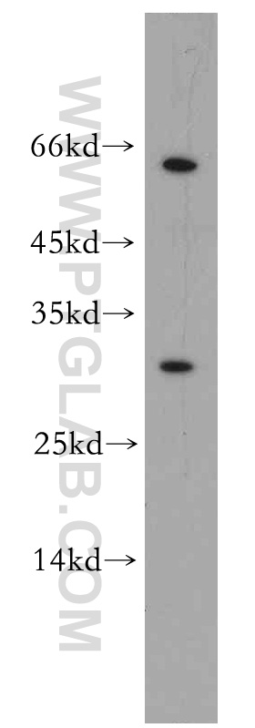 WB analysis of mouse liver using 15598-1-AP