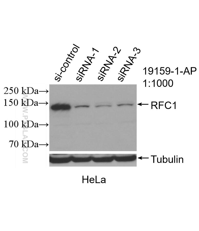 WB analysis of HeLa using 19159-1-AP