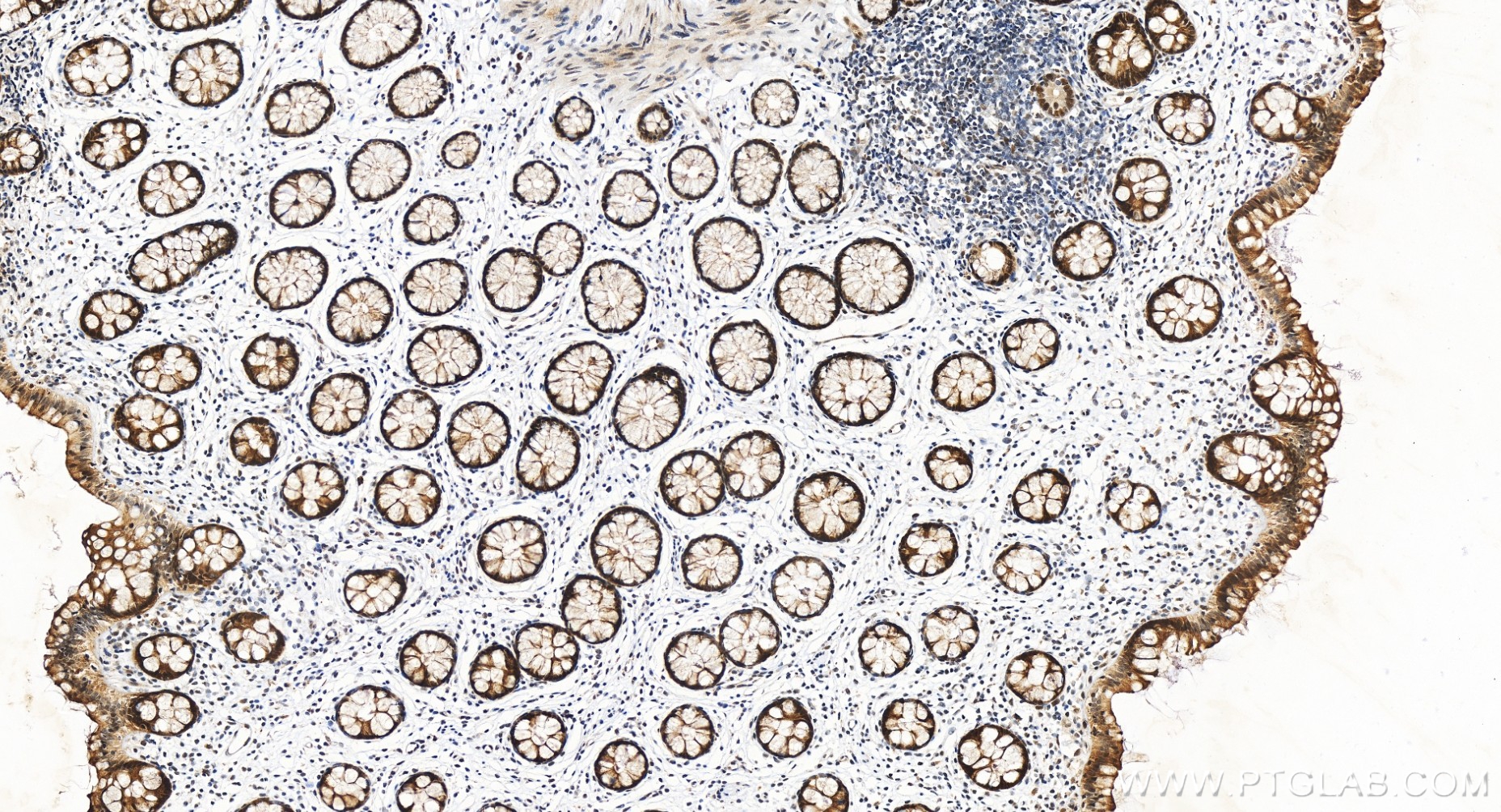IHC staining of human colon using 85148-4-RR