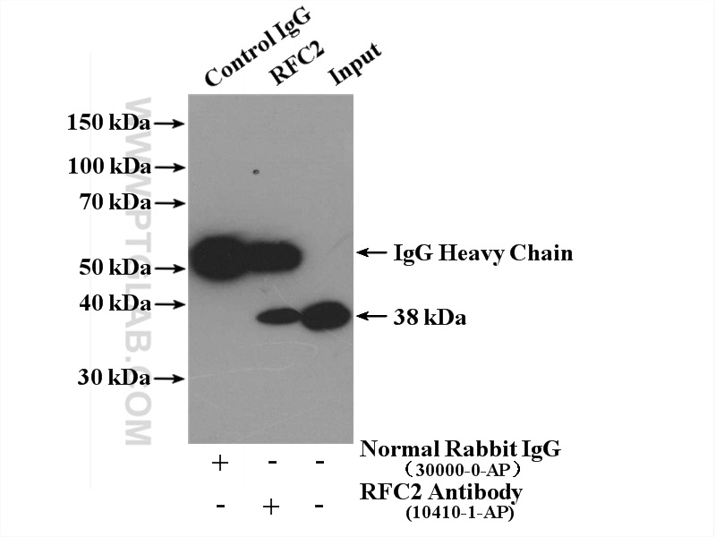 IP experiment of HeLa using 10410-1-AP