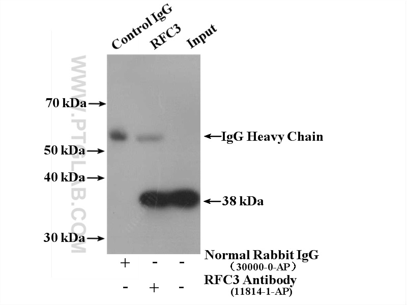 IP experiment of HeLa using 11814-1-AP