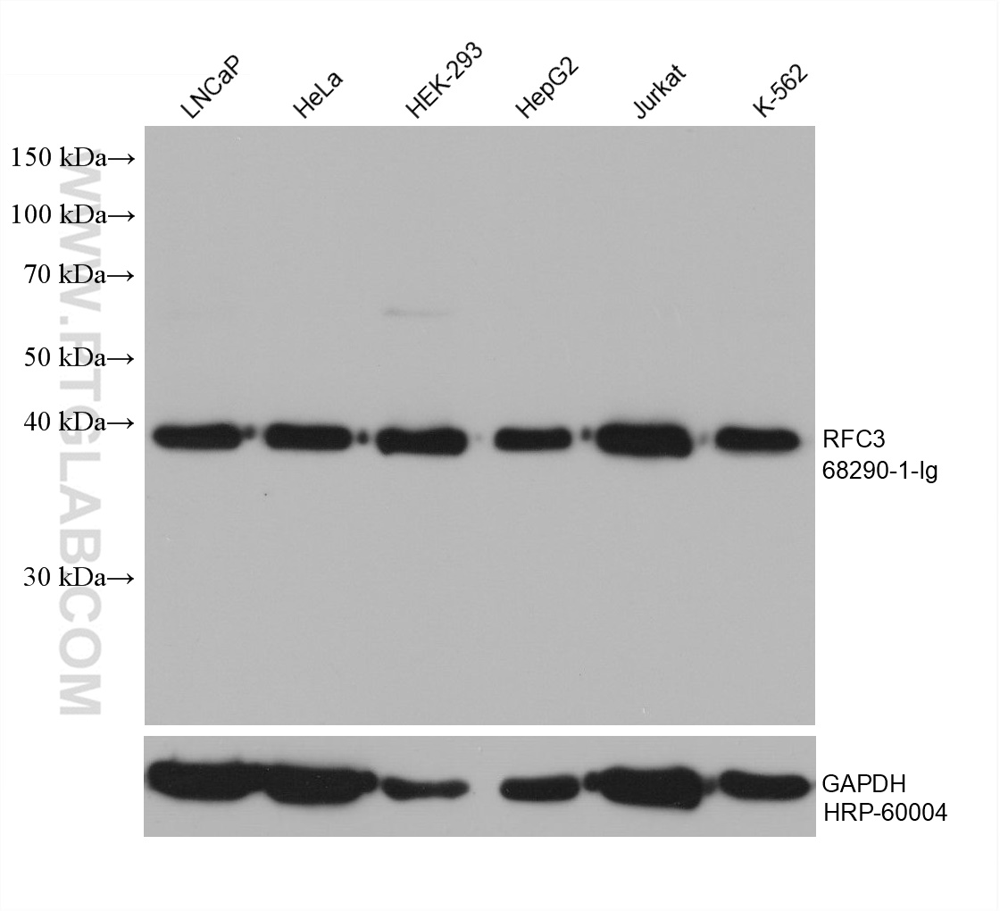 WB analysis using 68290-1-Ig (same clone as 68290-1-PBS)