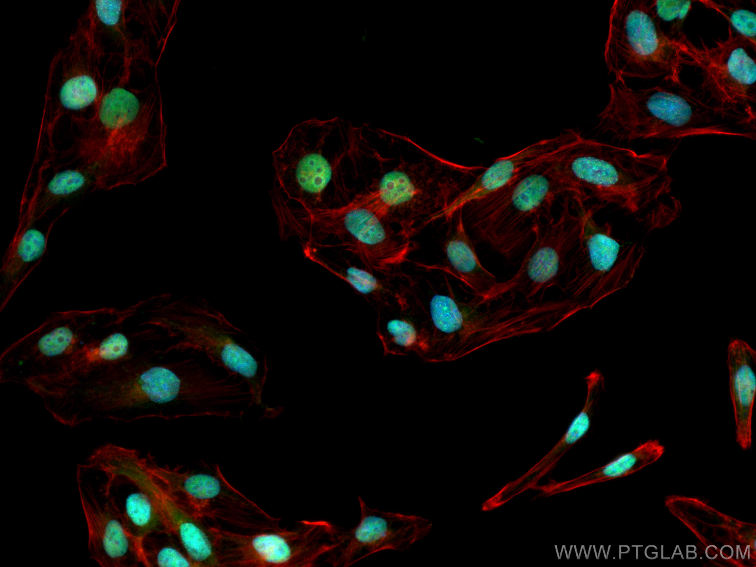 IF Staining of U2OS using 10806-1-AP