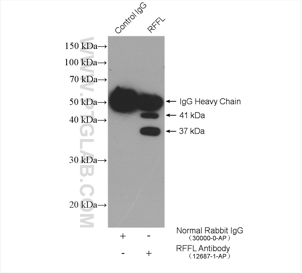 IP experiment of mouse testis using 12687-1-AP