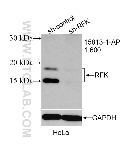 WB result of RFK antibody (15813-1-AP; 1:600; incubated at room temperature for 1.5 hours) with sh-Control and sh-RFK transfected HeLa cells. WB analysis of HeLa using 15813-1-AP