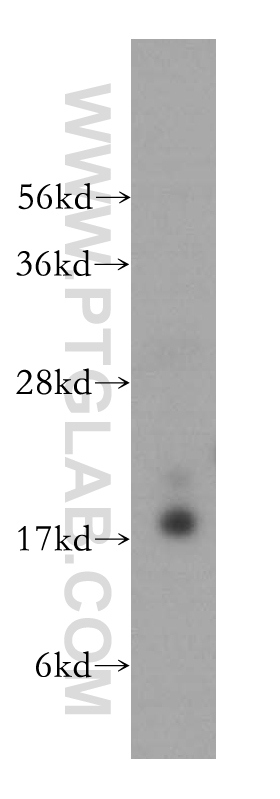 WB analysis of HeLa using 15813-1-AP