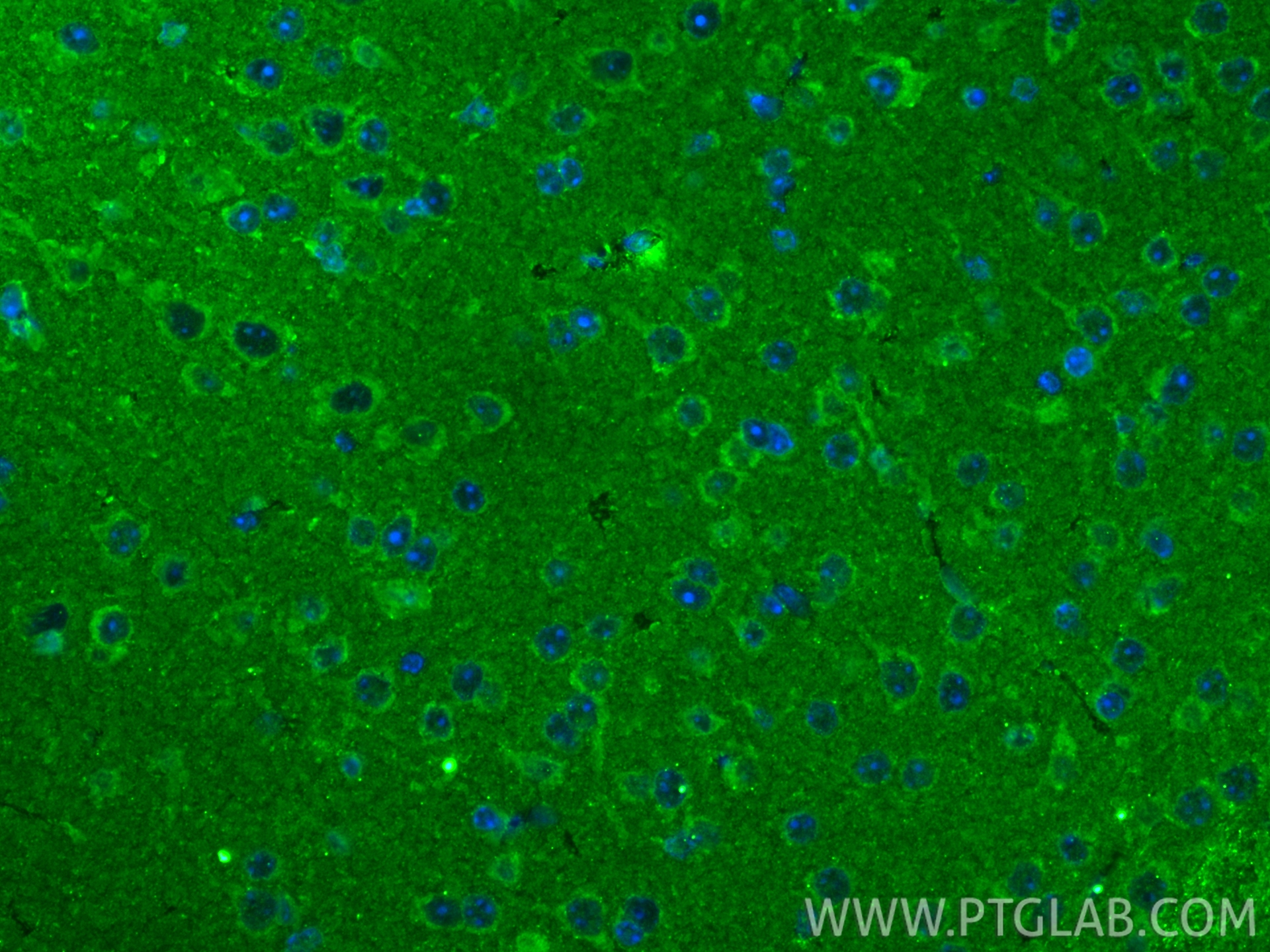 IF Staining of mouse brain using 85032-2-RR (same clone as 85032-2-PBS) IF Staining of mouse brain using 85032-2-RR (same clone as 85032-2-PBS)
