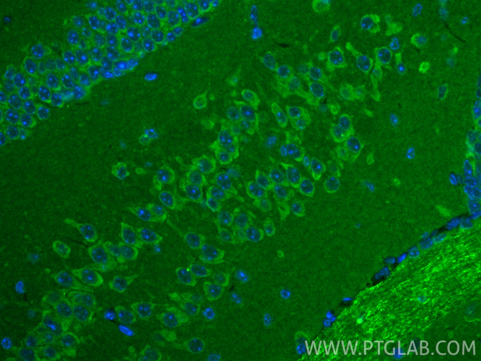 IF Staining of mouse brain using 85032-2-RR (same clone as 85032-2-PBS) IF Staining of mouse brain using 85032-2-RR (same clone as 85032-2-PBS)