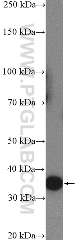 WB analysis of HeLa using 13215-1-AP