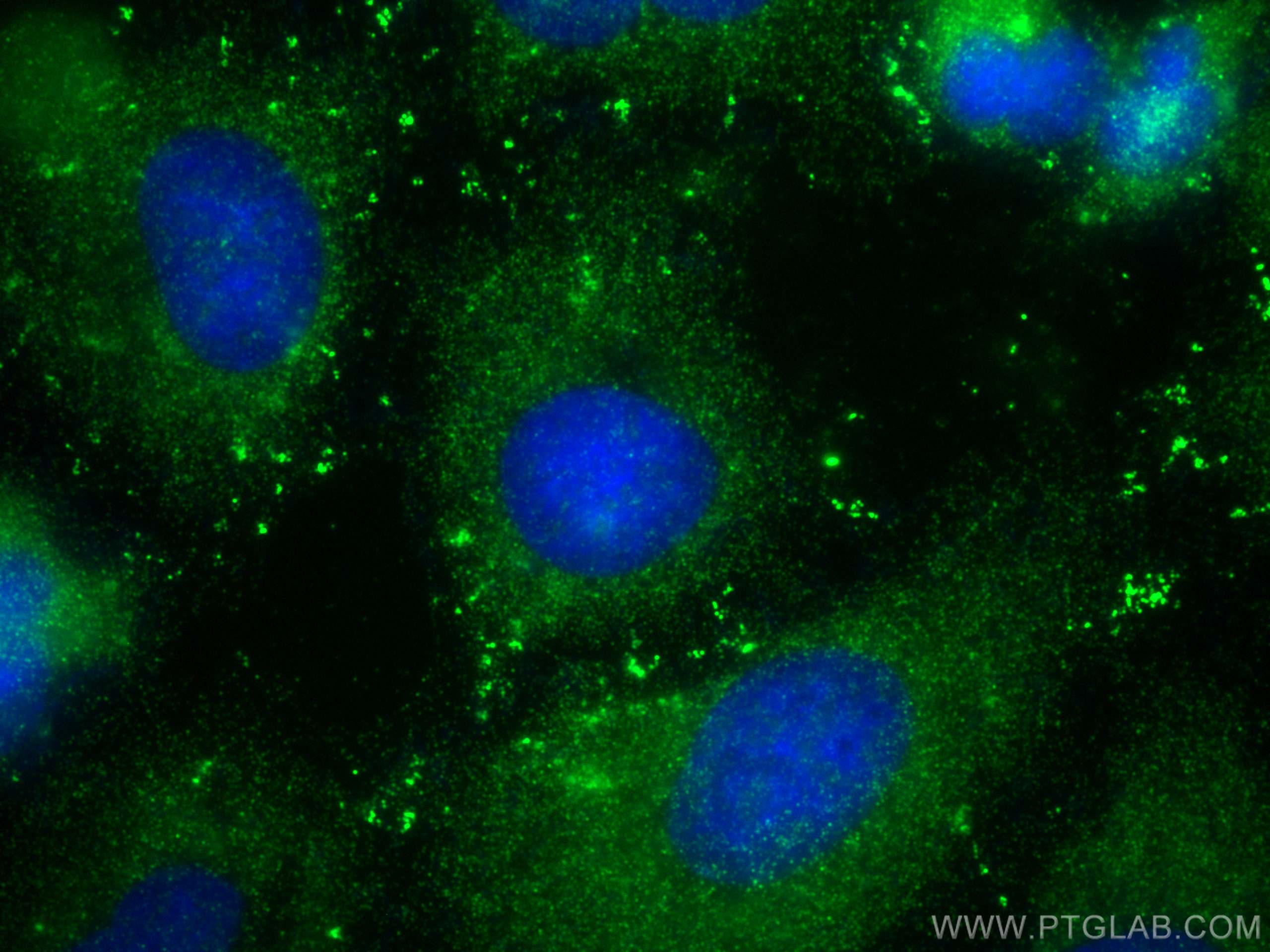 IF Staining of A549 using 20207-1-AP