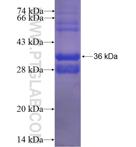 RFT1 fusion protein Ag24257 SDS-PAGE RFT1 fusion protein Ag24257 SDS-PAGE