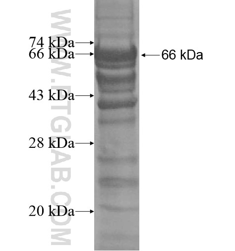 RFTN2 fusion protein Ag12397 SDS-PAGE RFTN2 fusion protein Ag12397 SDS-PAGE