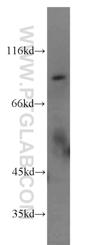 WB analysis of mouse lung using 19893-1-AP