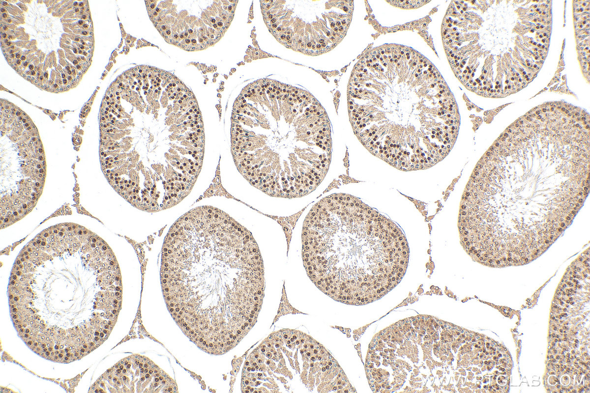 IHC staining of rat testis using 12622-1-AP