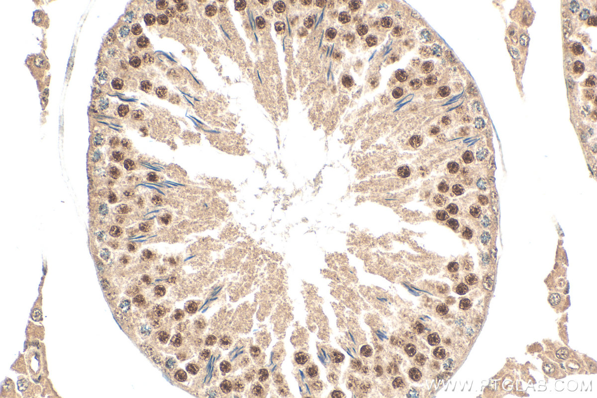 IHC staining of rat testis using 12622-1-AP