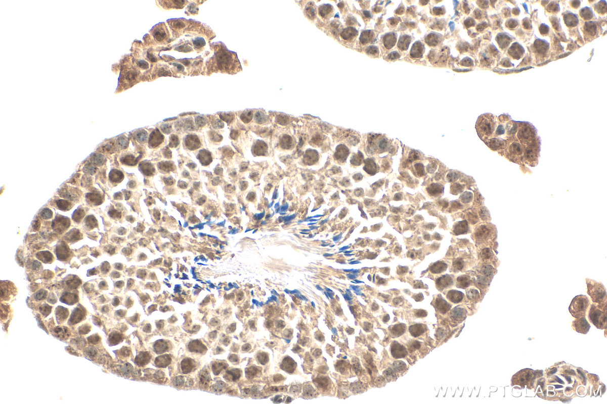 IHC staining of mouse testis using 12622-1-AP
