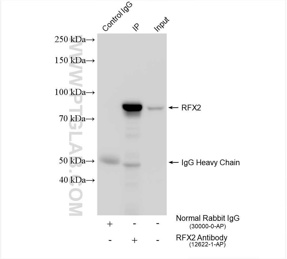 IP experiment of THP-1 using 12622-1-AP