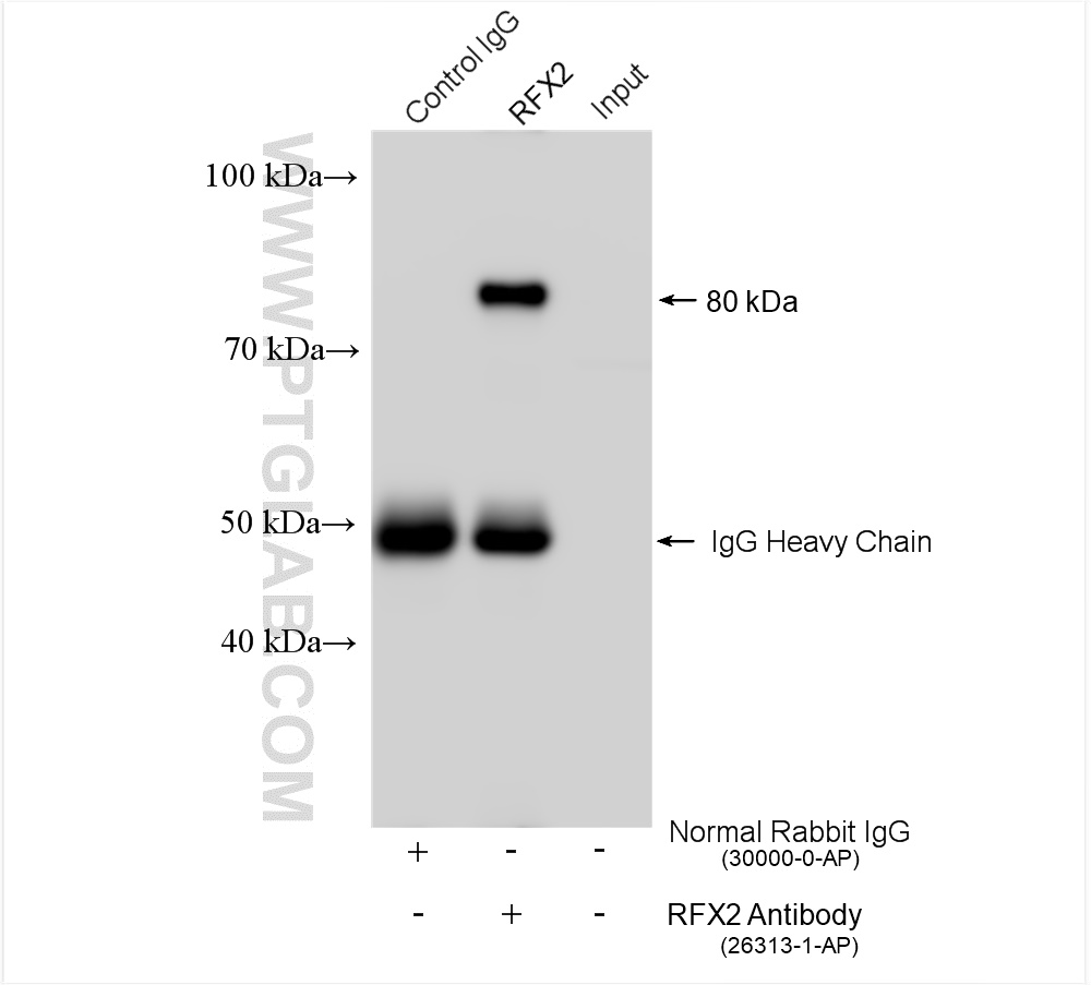 IP experiment of mouse testis using 26313-1-AP