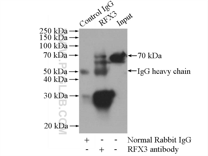 IP experiment of HeLa using 14784-1-AP