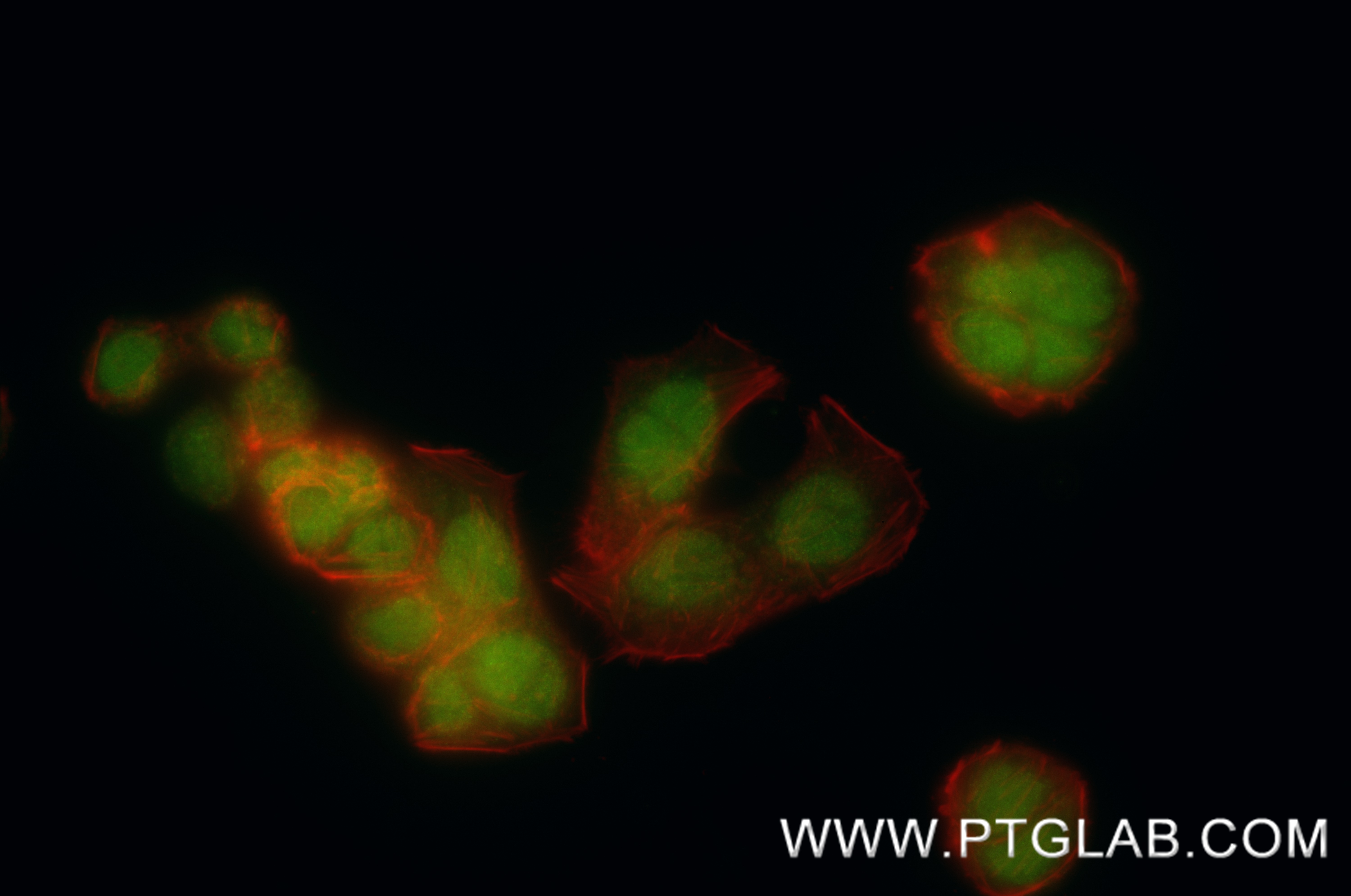 IF Staining of HT-29 using 86413-1-RR (same clone as 86413-1-PBS) IF Staining of HT-29 using 86413-1-RR (same clone as 86413-1-PBS)