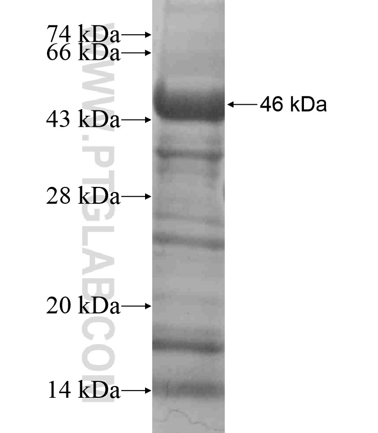 RFX6 fusion protein Ag18354 SDS-PAGE RFX6 fusion protein Ag18354 SDS-PAGE