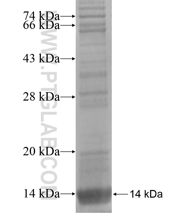 RFXANK fusion protein Ag18515 SDS-PAGE