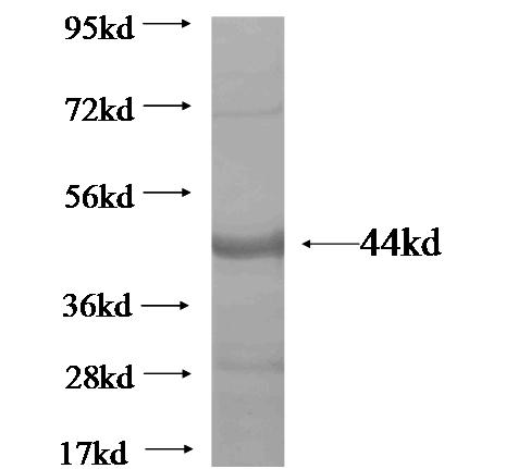 RGAG1 fusion protein Ag20407 SDS-PAGE RGAG1 fusion protein Ag20407 SDS-PAGE