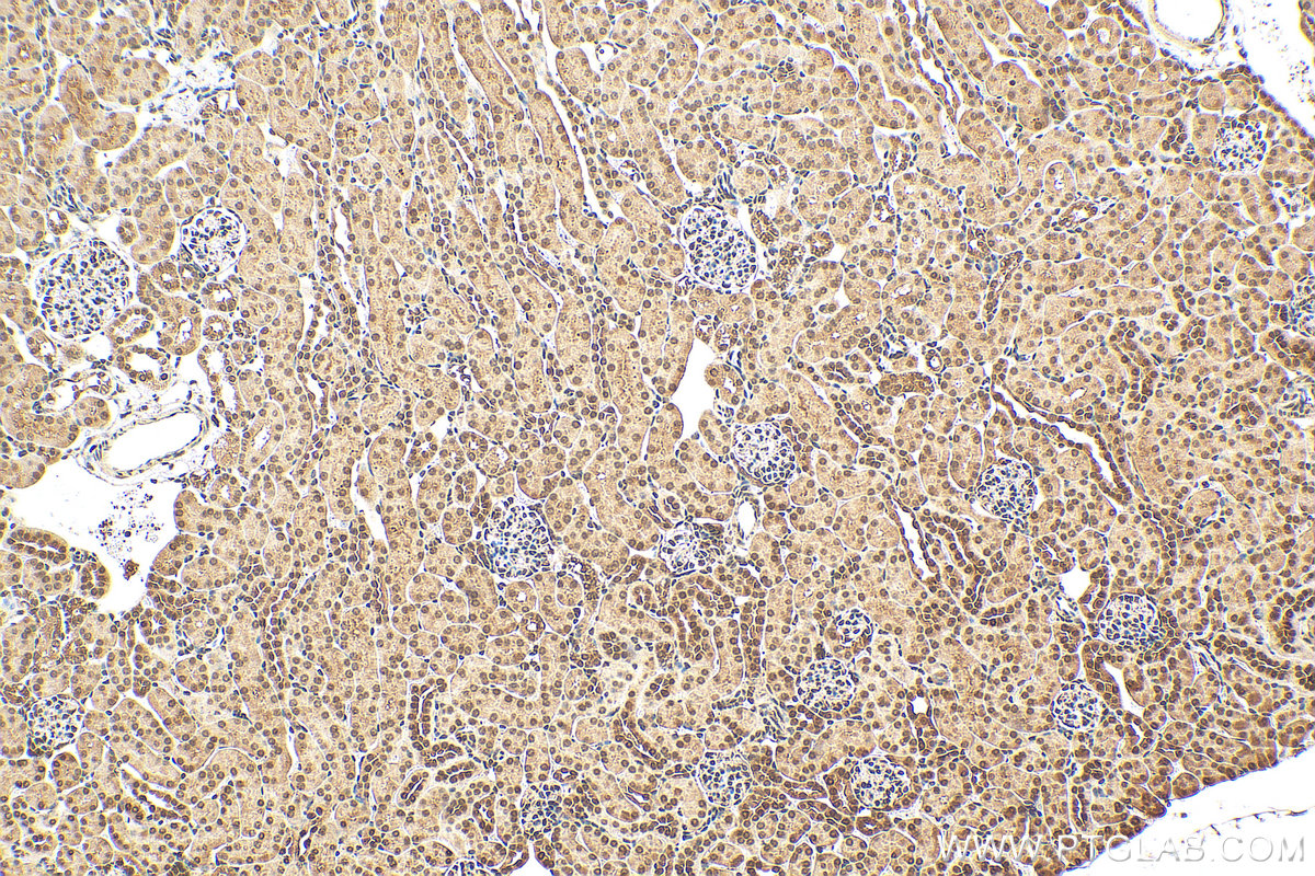 IHC staining of mouse kidney using 19556-1-AP