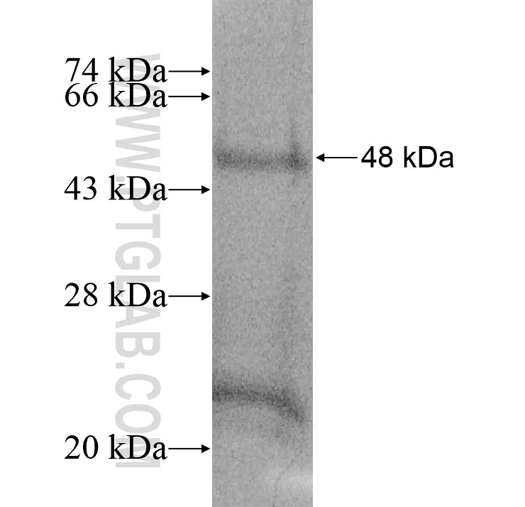 RGL3 fusion protein Ag13116 SDS-PAGE RGL3 fusion protein Ag13116 SDS-PAGE