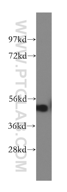 WB analysis of mouse testis using 12387-1-AP