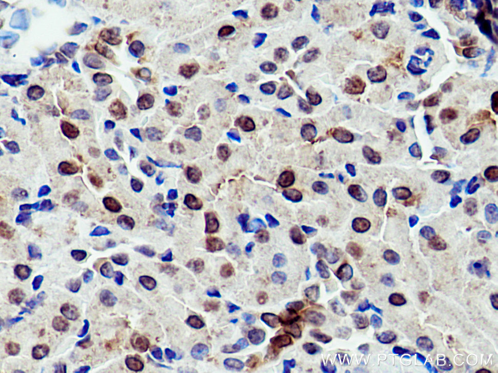 IHC staining of rat kidney using 17947-1-AP