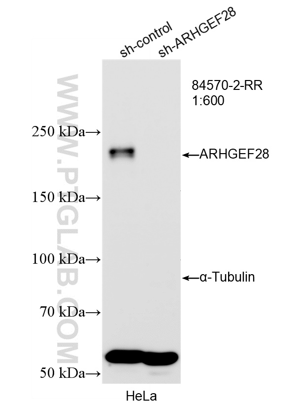 WB analysis of HeLa using 84570-2-RR (same clone as 84570-2-PBS)