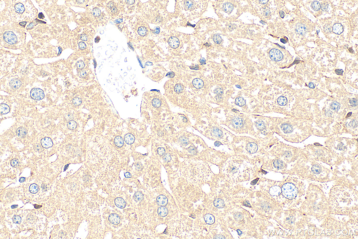 IHC staining of mouse liver using 31636-1-AP IHC staining of mouse liver using 31636-1-AP