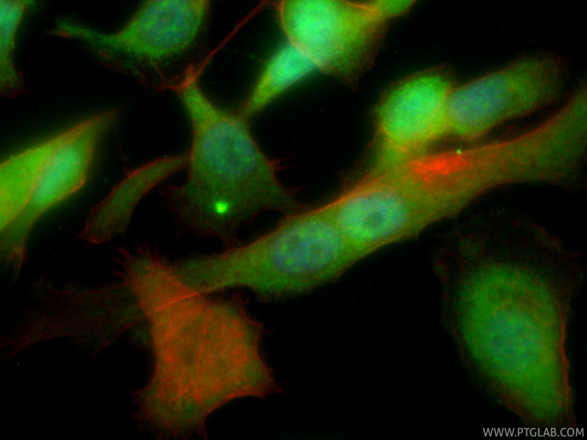 IF Staining of PC-3 using CL488-85057-2