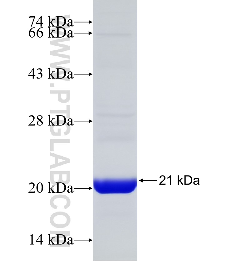 RGS12 fusion protein Ag30744 SDS-PAGE RGS12 fusion protein Ag30744 SDS-PAGE