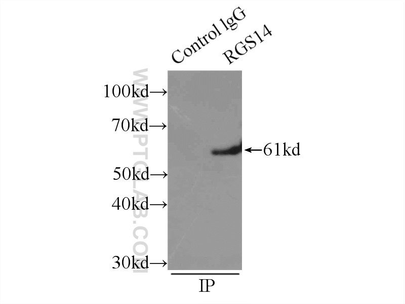 IP experiment of mouse brain using 16258-1-AP