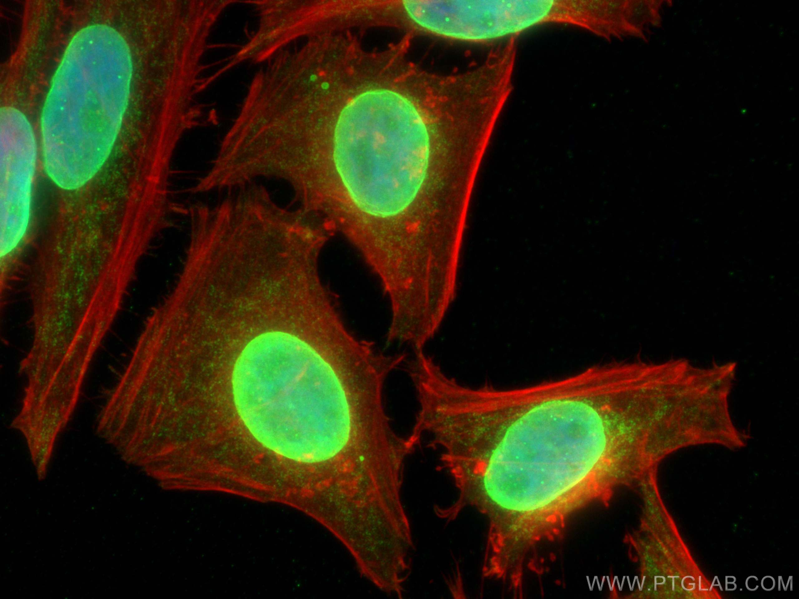 IF Staining of HeLa using 67394-1-Ig