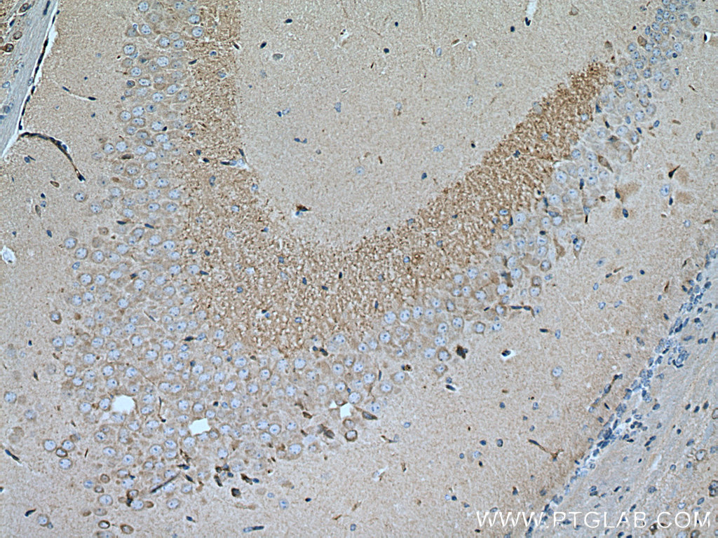 IHC staining of mouse brain using 67394-1-Ig