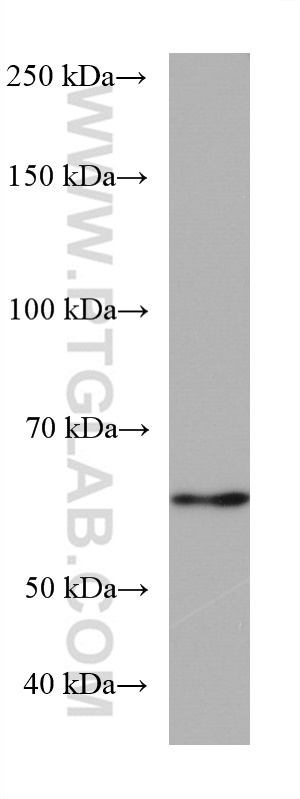 WB analysis of mouse brain using 67394-1-Ig