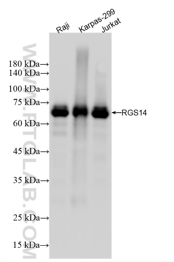 WB analysis using 87396-1-RR WB analysis using 87396-1-RR
